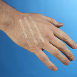 WOUND CLOSURE STERILE STRIPS 3X75MM X50